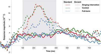 Auditory Processing of the Brain Is Enhanced by Parental Singing for Preterm Infants